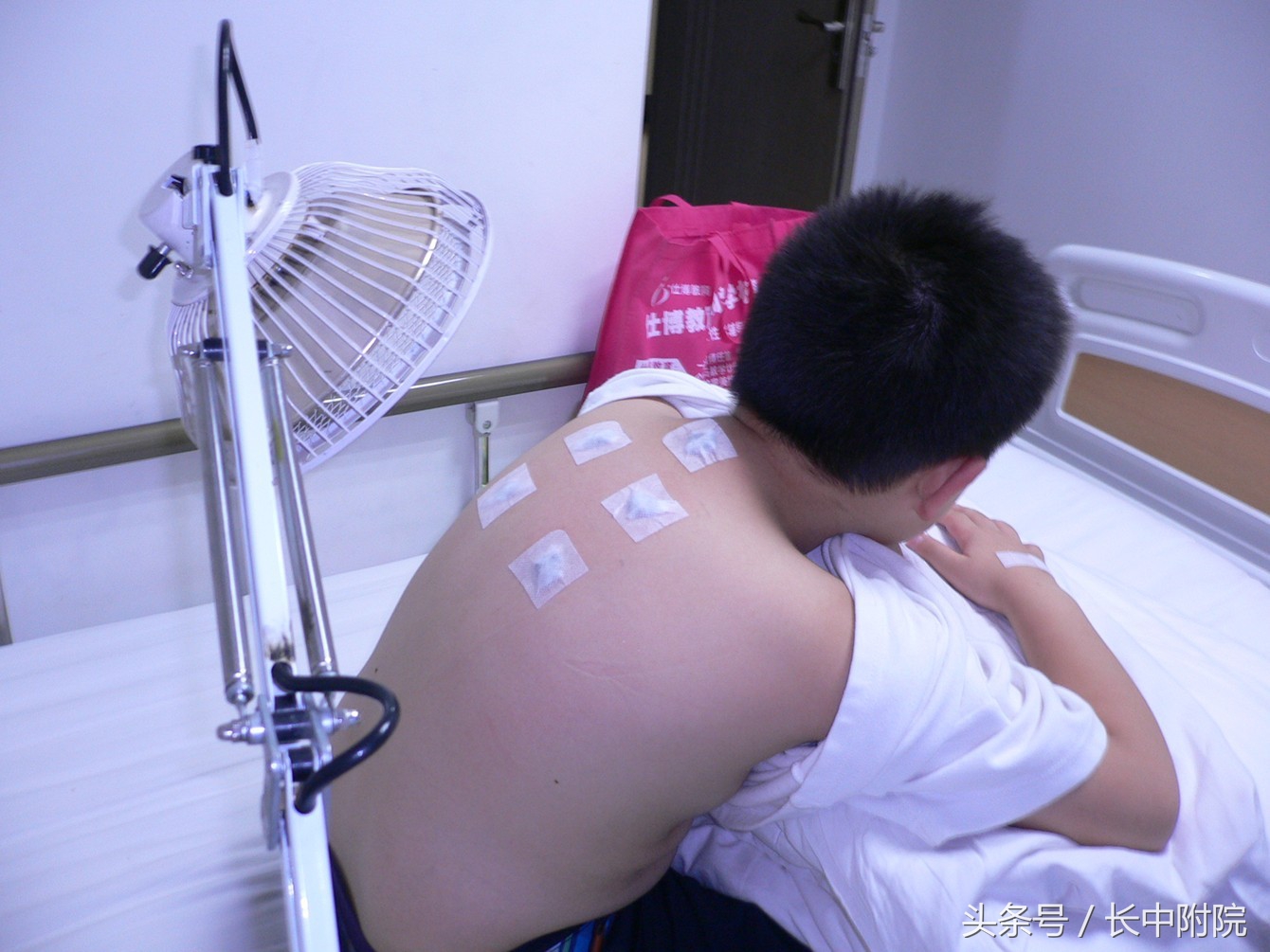 鼻炎高发期怎么治疗最有效,夏秋换季鼻炎高发专家来支招