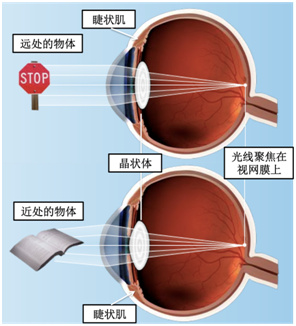 为什么配眼镜都要配纯钛呢,配眼镜验光需要散瞳吗