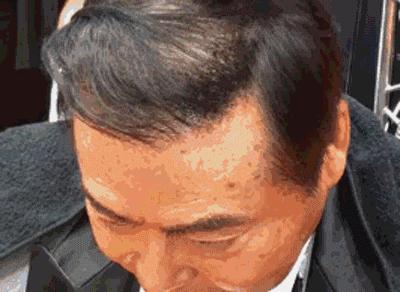 岛国发明遮秃喷雾,只要喷一喷,‘地中海’‘秒变’‘热带雨林’!