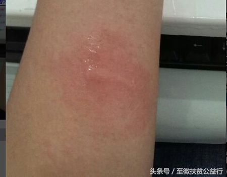 农村动物界的“四大天王”!招惹它们定会让你痛不欲生!