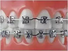 牙缝大的女人漏财吗,牙缝漏财吗