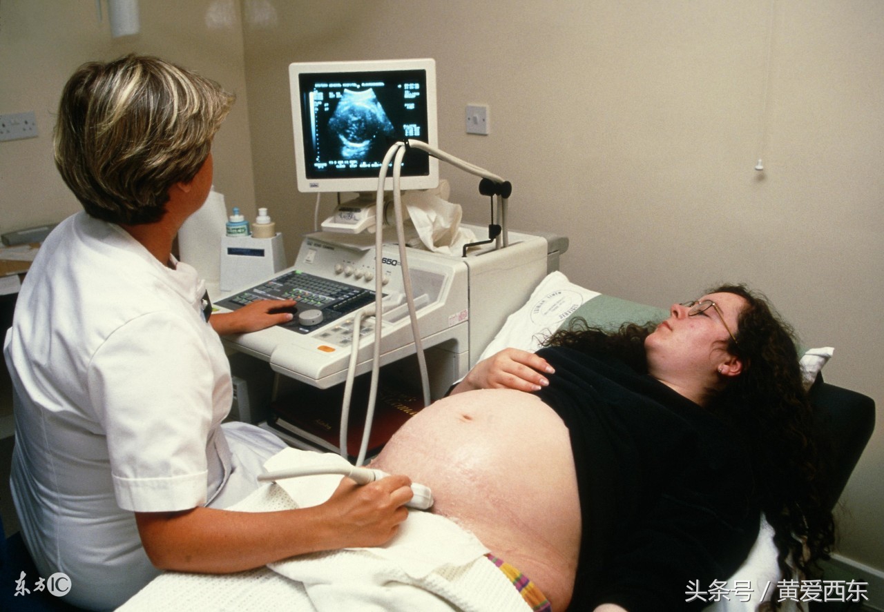 你不懂!女人生孩子的疼痛是十级!痛不欲生!生不如死!