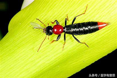 孕妇隐翅虫叮咬后皮肤溃烂,隐翅虫叮过后用蚊虫叮咬膏有效吗