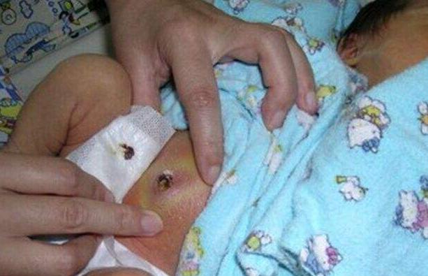 新手妈妈导致婴儿死亡事件,新手妈妈带娃出现的意外