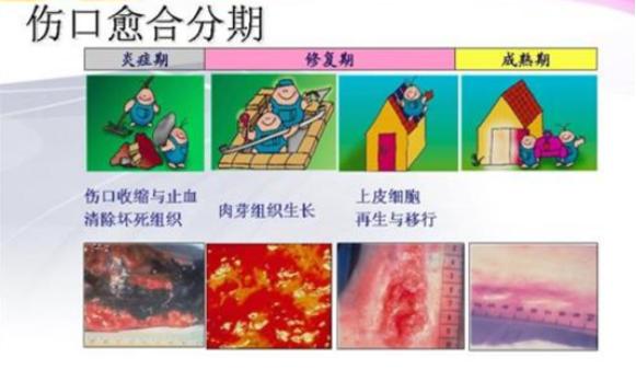 术后不吃发物要忌口多久,术后要忌口发物多久