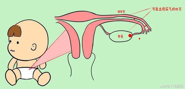 小儿疝气平时需要注意事项,小儿疝气需要注意什么