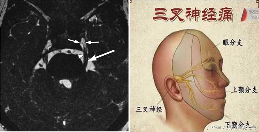 牙痛绝非小事有可能是大病前兆,牙痛可能是什么病的前兆