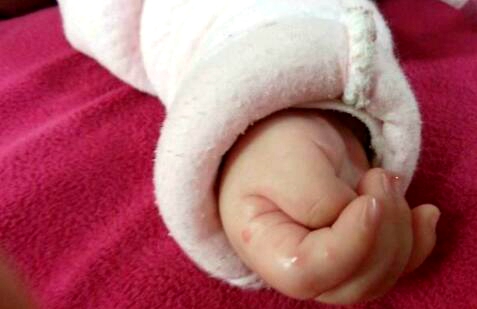 宝宝的拇指内扣怎么回事,宝宝三个半月大拇指内扣怎么办