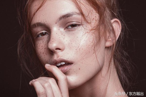 祛斑最好的方法目前最有效的,手上老年斑祛斑最有效方法