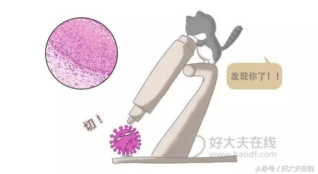 真人讲述：“HPV阳性”就诊体验