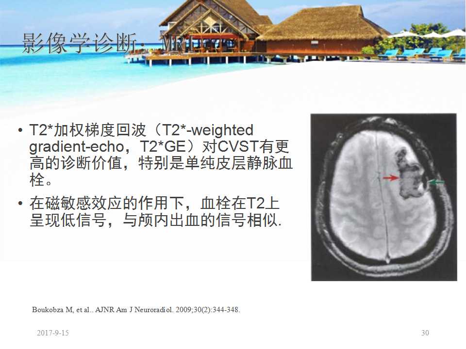 颅内静脉窦血栓形成怎么治疗,颅内静脉窦血栓怎么治疗