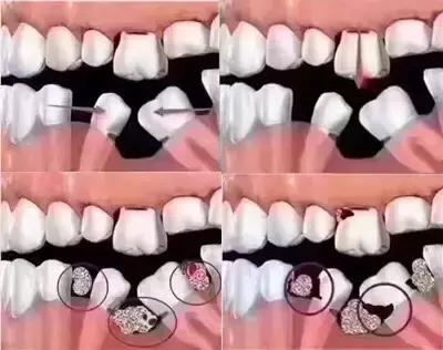 经常梦到牙齿松动脱落怎么回事,牙齿松动咬不动硬的菜怎么回事