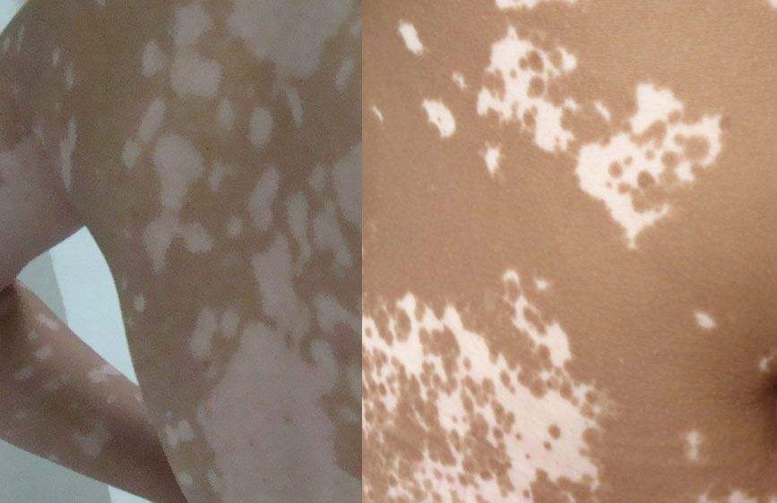 关注儿童心理健康让孩子远离焦虑,关注孩子视力健康近视防控