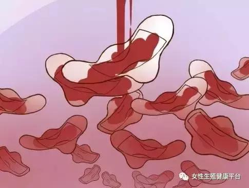 50岁女子10年长了108个子宫肌瘤,女子子宫肌瘤10年不治竟取出109颗