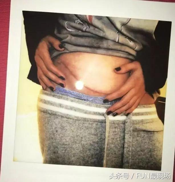 赛琳娜和闺蜜,赛琳娜和捐肾闺蜜闹翻是真的吗