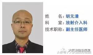 卵巢囊肿（及巧克力囊肿），放射介入副主任医师给你的治疗方案