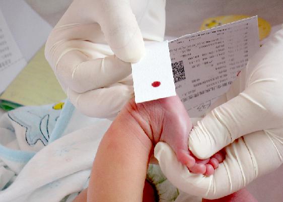 新生儿足跟血可以检查智力吗,新生儿足跟血哪一项影响生长发育