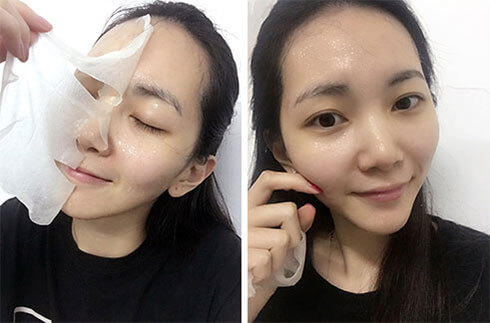 跟我这样做,不出3个月,痘痘全消散