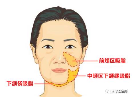 邢晓瑶走红化妆视频,邢晓瑶是怎么变瘦的