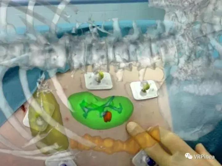 诺基亚已全面复苏htc何时才能觉醒,htc诺基亚苹果