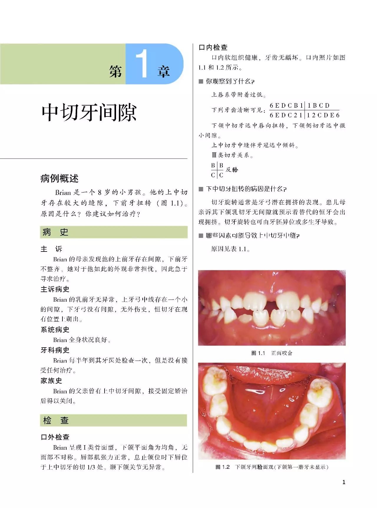 口腔正畸临床高效矫治书籍,口腔大咖正畸分享病例