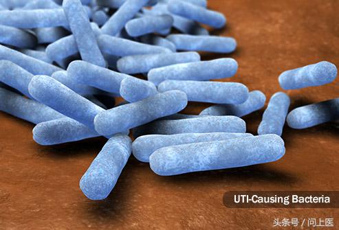 尿液还有哪些常见的危害,尿液有问题一般会有哪些疾病