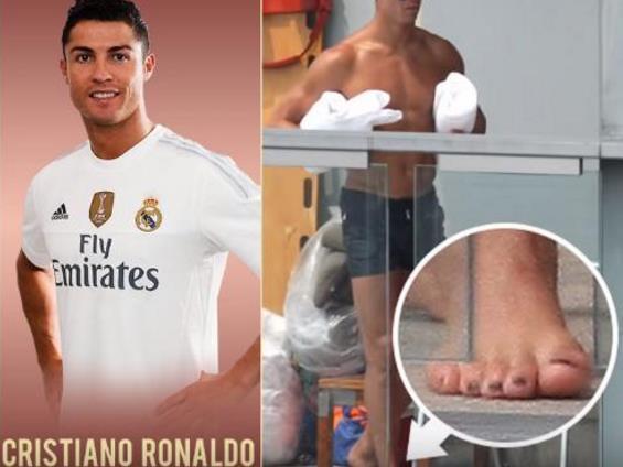 看脚就知道他们为什么是球坛巨星,詹姆斯完全变形,C罗脚趾发肿