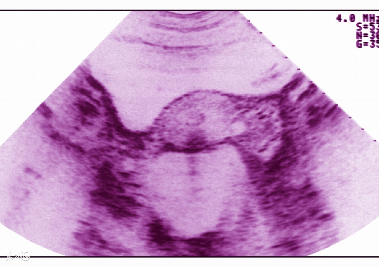 百姓对疾病筛查认知度,各个疾病的辅助检查口诀