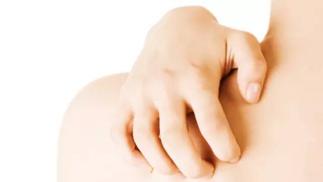 婴儿红斑丘疹样湿疹怎么治疗,儿童手背丘疹性湿疹用什么药膏