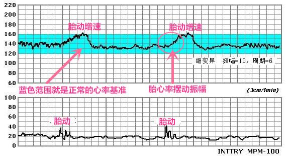 从孕32周后，一定要做这项检查，能最快最直接判断胎儿健康情况