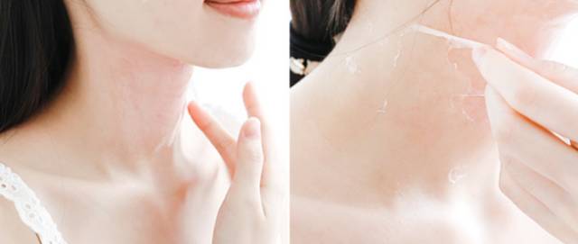 一条颈纹老十岁教你一招淡化,年纪小就有一条很深的颈纹