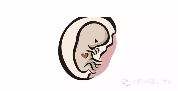 产科医生谈羊水过少,产科医生谈羊水栓塞