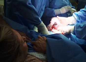 实拍胎儿剖腹产过程，“捧在手里怕摔了，含在嘴里怕化了”！