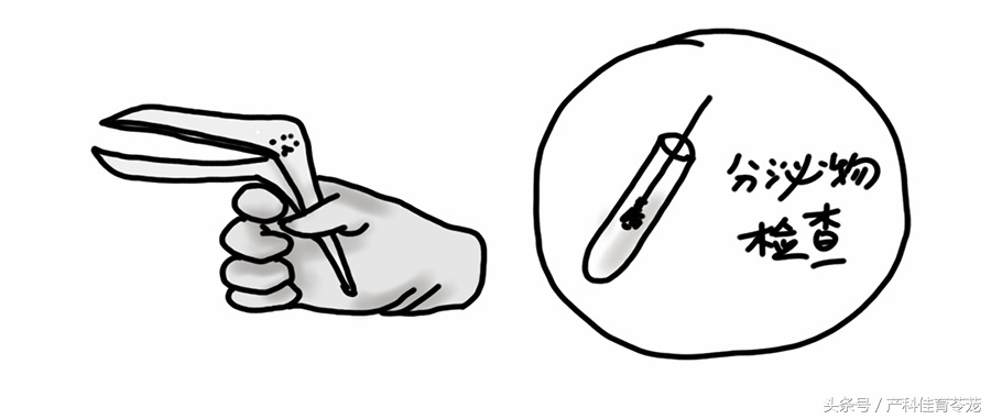 卫生部人工流产术操作教学,微管可视无痛人工流产术全过程