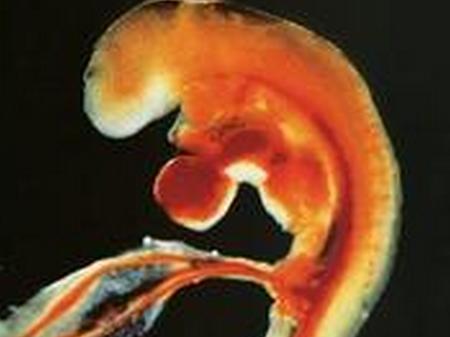 了解胎囊、胎芽、胎心到底是什么？