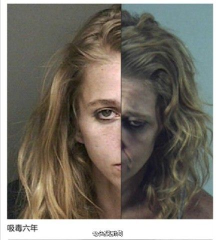 “僵尸浴盐”，吸食后宛如丧尸，上演现实版行尸走肉