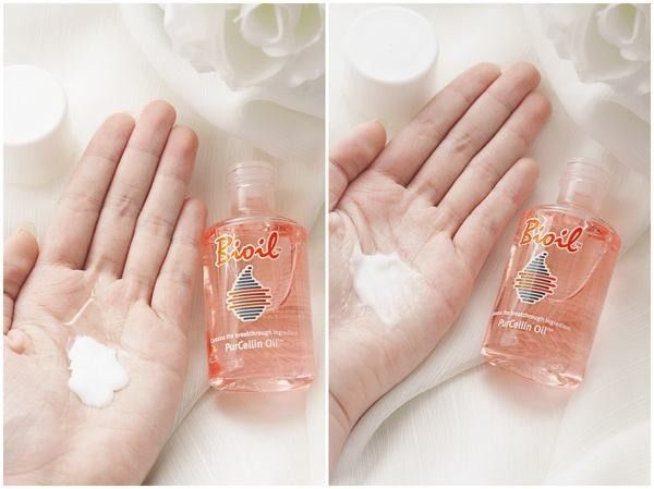 深扒“网红”神油,8周改善妊娠纹和疤痕~