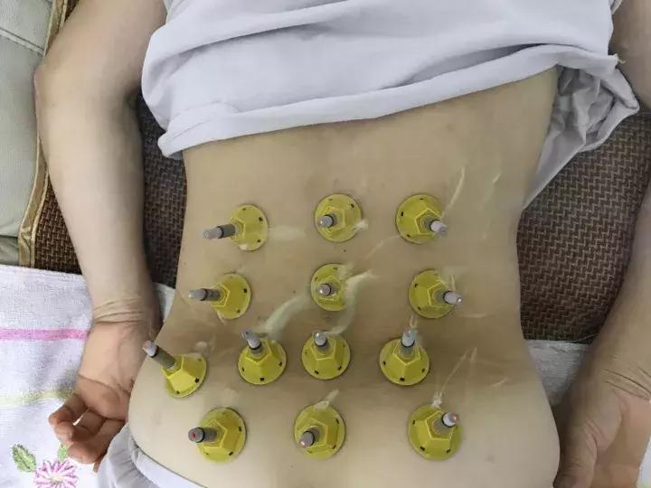 天冷手脚冰凉可以艾灸脚吗,天冷手脚冰凉可以艾灸涌泉穴吗