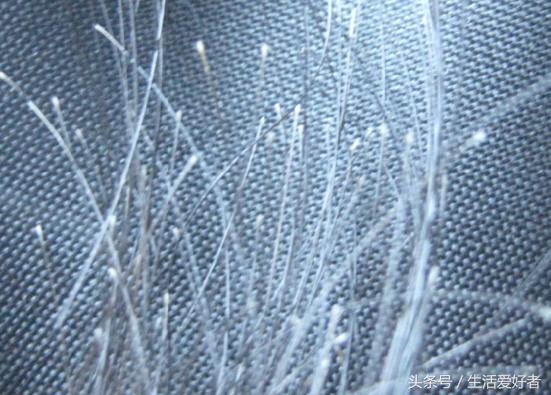 掉头发不多，但就是不长，有什么原因？如何让头发快速生长？