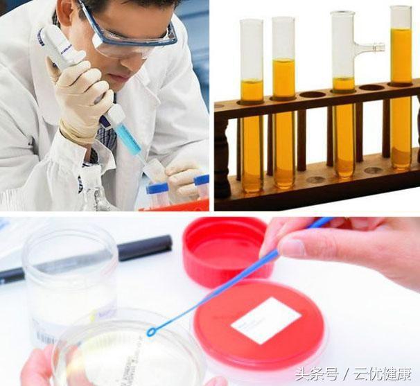 如何从尿液判断疾病,疾病数据哪里查询