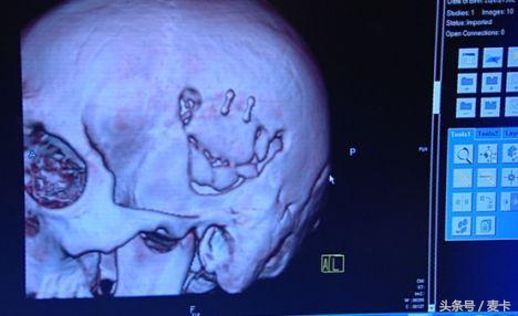 切尔西灭门惨案,切尔西vs雷丁灭门惨案