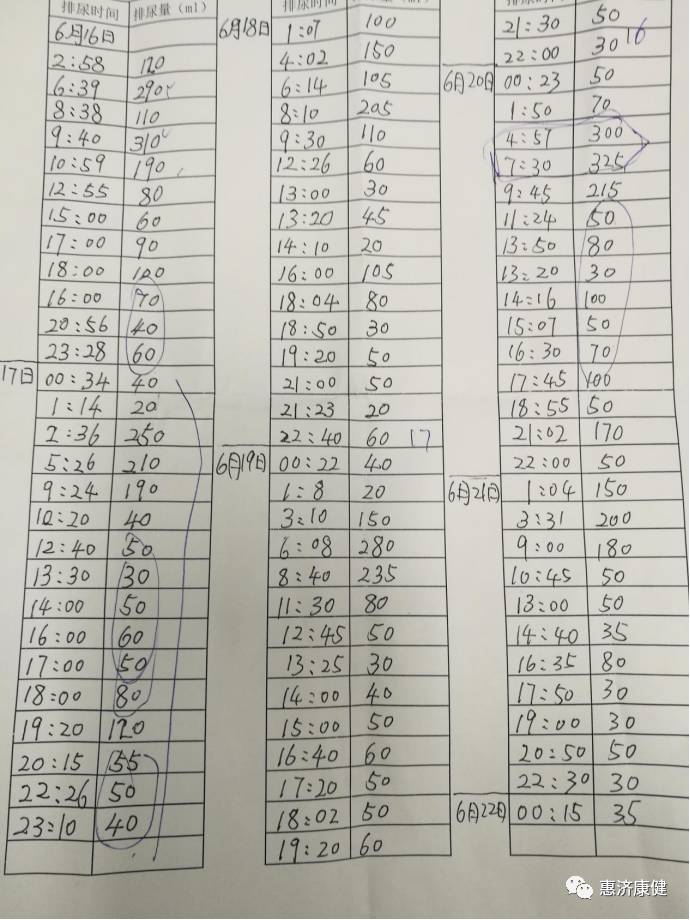 一招让你远离尿频,女人尿频自愈小妙招