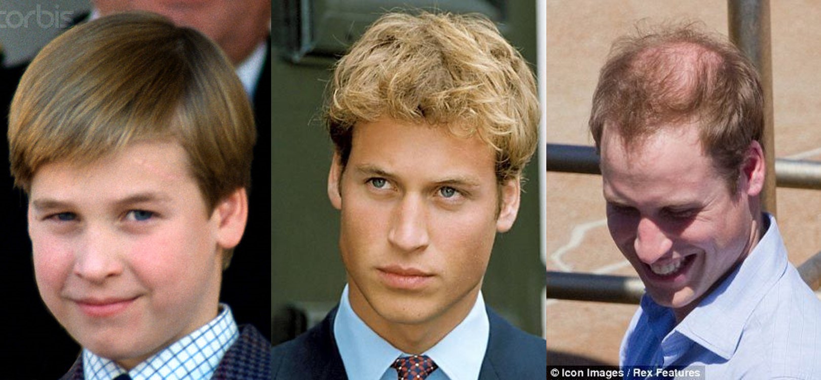 解脱|大好*光春**万物生，脱发掉发烦死人