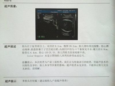末次月经怎么推算预产期,不记得末次月经如何推算孕周