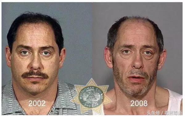 吸毒前后的变化对比,吸毒真的会毁容吗