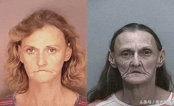 吸毒前后的变化对比,吸毒真的会毁容吗