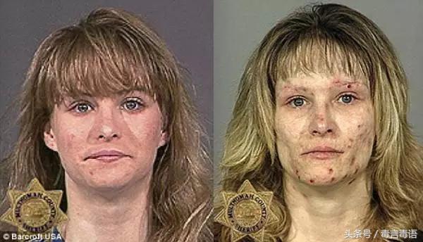 10个吸毒前后的惊人变化,吸毒的人吸毒前后对比图片