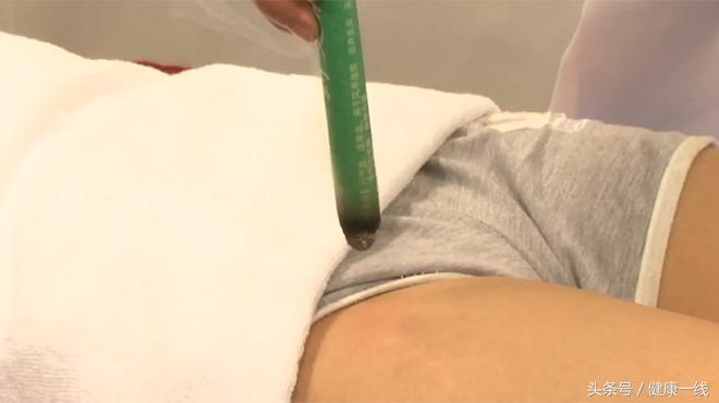 身体某部位一按就痛,疏通小腿外侧经脉怎样敲打