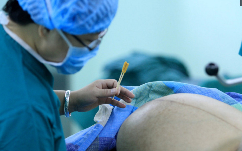 真正的宫缩痛刚开始是怎样的痛,宫缩痛到底是什么感觉呢