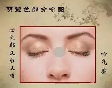 中医望诊鼻子发青,受凉鼻根发青是什么原因